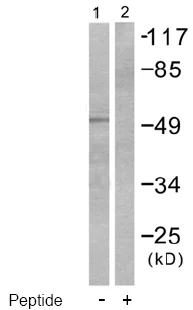 Western blot - Anti-Cytokeratin 7 antibody (AB53123)