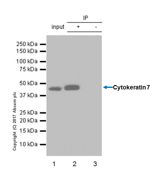 Immunoprecipitation - Anti-Cytokeratin 7 antibody [EP1620Y] - BSA and Azide free (AB181832)