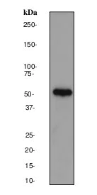 Western blot - Anti-Cytokeratin 7 antibody [EP1620Y] - BSA and Azide free (AB181832)