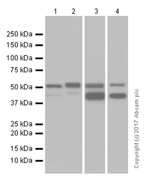 Western blot - Anti-Cytokeratin 7 antibody [EP1620Y] - BSA and Azide free (AB181832)