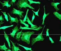 Immunocytochemistry/ Immunofluorescence - Anti-Cytokeratin 7 antibody [EPR1619Y] - Cytoskeleton Marker (AB68459)