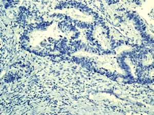 Immunohistochemistry (Formalin/PFA-fixed paraffin-embedded sections) - Anti-Cytokeratin 7 antibody [EPR1619Y] - Cytoskeleton Marker (AB68459)