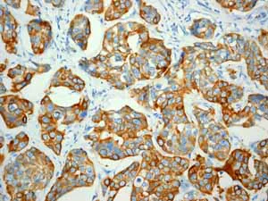 Immunohistochemistry (Formalin/PFA-fixed paraffin-embedded sections) - Anti-Cytokeratin 7 antibody [EPR1619Y] - Cytoskeleton Marker (AB68459)