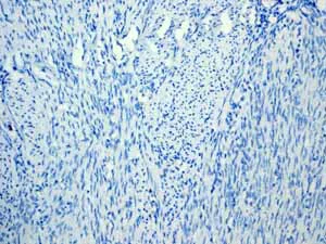 Immunohistochemistry (Formalin/PFA-fixed paraffin-embedded sections) - Anti-Cytokeratin 7 antibody [EPR1619Y] - Cytoskeleton Marker (AB68459)