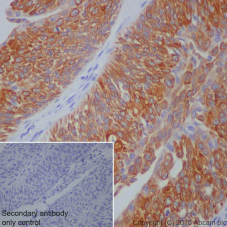 Immunohistochemistry (Formalin/PFA-fixed paraffin-embedded sections) - Anti-Cytokeratin 7 antibody [EPR1619Y] - Cytoskeleton Marker (AB68459)