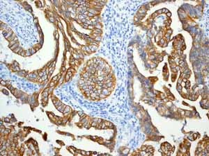 Immunohistochemistry (Formalin/PFA-fixed paraffin-embedded sections) - Anti-Cytokeratin 7 antibody [EPR1619Y] - Cytoskeleton Marker (AB68459)
