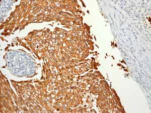 Immunohistochemistry (Formalin/PFA-fixed paraffin-embedded sections) - Anti-Cytokeratin 7 antibody [EPR1619Y] - Cytoskeleton Marker (AB68459)