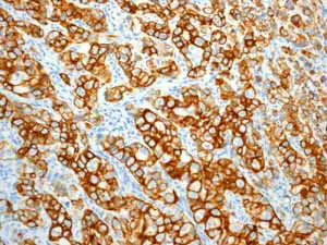 Immunohistochemistry (Formalin/PFA-fixed paraffin-embedded sections) - Anti-Cytokeratin 7 antibody [EPR1619Y] - Cytoskeleton Marker (AB68459)