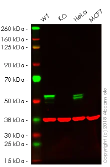 Western blot - Anti-Cytokeratin 7 antibody [EPR1619Y] - Cytoskeleton Marker (AB68459)