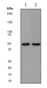 Western blot - Anti-Cytokeratin 7 antibody [EPR1619Y] - Cytoskeleton Marker (AB68459)