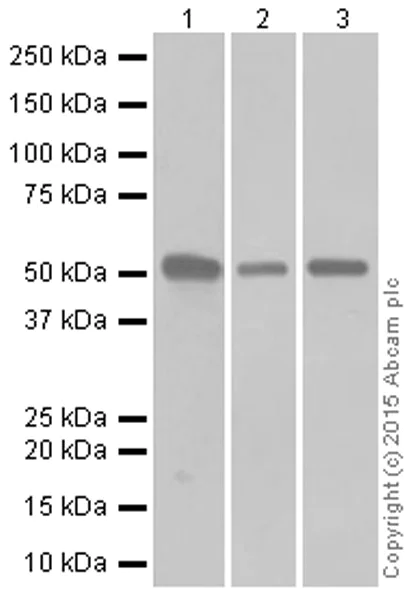Western blot - Anti-Cytokeratin 7 antibody [EPR1619Y] - Cytoskeleton Marker (AB68459)