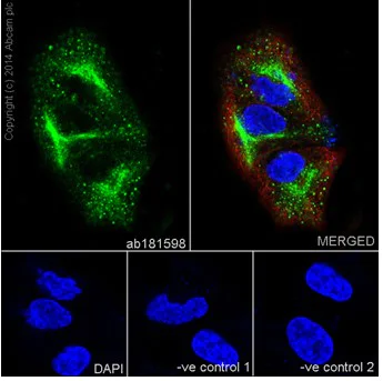 Immunocytochemistry/ Immunofluorescence - Anti-Cytokeratin 7 antibody [EPR17078] - BSA and Azide free (AB220804)