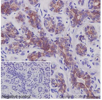 Immunohistochemistry (Formalin/PFA-fixed paraffin-embedded sections) - Anti-Cytokeratin 7 antibody [EPR17078] - Cytoskeleton Marker (AB181598)