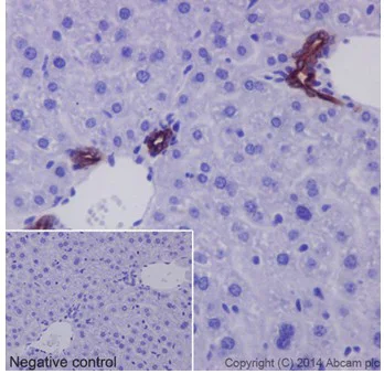 Immunohistochemistry (Formalin/PFA-fixed paraffin-embedded sections) - Anti-Cytokeratin 7 antibody [EPR17078] - Cytoskeleton Marker (AB181598)