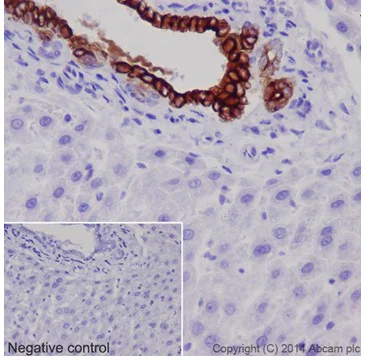 Immunohistochemistry (Formalin/PFA-fixed paraffin-embedded sections) - Anti-Cytokeratin 7 antibody [EPR17078] - Cytoskeleton Marker (AB181598)