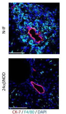 はま Anti-cytokeratin 7 antibody [EPR17078] - cytoskeleton marker