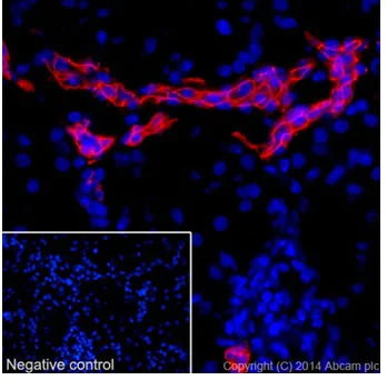 Immunohistochemistry (Frozen sections) - Anti-Cytokeratin 7 antibody [EPR17078] - Cytoskeleton Marker (AB181598)