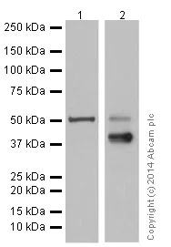 Western blot - Anti-Cytokeratin 7 antibody [EPR17078] - Cytoskeleton Marker (AB181598)