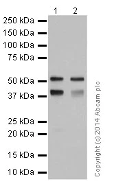 はま Anti-cytokeratin 7 antibody [EPR17078] - cytoskeleton marker