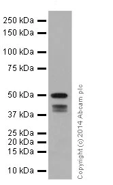 Western blot - Anti-Cytokeratin 7 antibody [EPR17078] - Cytoskeleton Marker (AB181598)