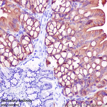 Immunohistochemistry (Formalin/PFA-fixed paraffin-embedded sections) - Anti-Cytokeratin 7 antibody [EPR17079] (ab199718), expandable thumbnail