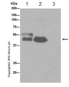 Immunoprecipitation - Anti-Cytokeratin 7 antibody [EPR17079] (AB199718), expandable thumbnail