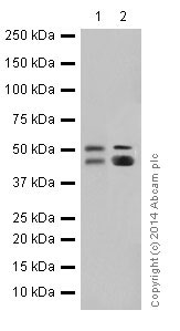 Western blot - Anti-Cytokeratin 7 antibody [EPR17079] (AB199718), expandable thumbnail