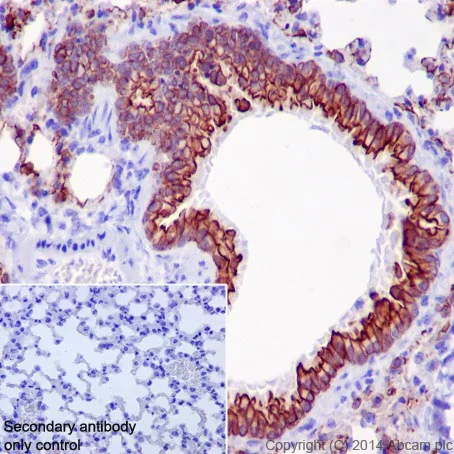 Immunohistochemistry (Formalin/PFA-fixed paraffin-embedded sections) - Anti-Cytokeratin 7 antibody [EPR17079] - BSA and Azide free (AB251287)