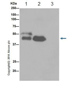 Immunoprecipitation - Anti-Cytokeratin 7 antibody [EPR17079] - BSA and Azide free (AB251287)