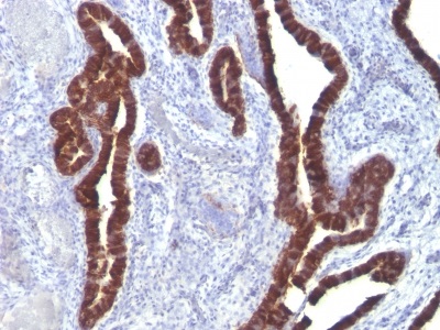 Immunohistochemistry (Formalin/PFA-fixed paraffin-embedded sections) - Anti-Cytokeratin 7 antibody [K72.7] (AB233904), expandable thumbnail