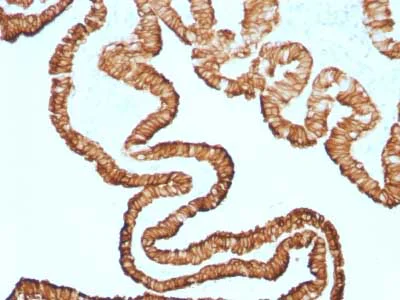 Anti-Cytokeratin 7 antibody [KRT7/1499R] (ab218440) | Abcam