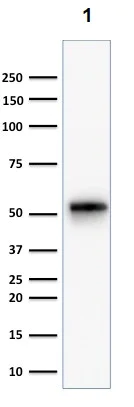 Western blot - Anti-Cytokeratin 7 antibody [KRT7/1499R] (AB218440)