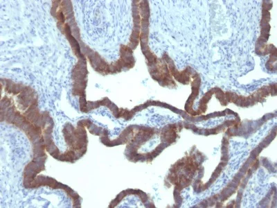 Immunohistochemistry (Formalin/PFA-fixed paraffin-embedded sections) - Anti-Cytokeratin 7 antibody [KRT7/903] (AB233905)