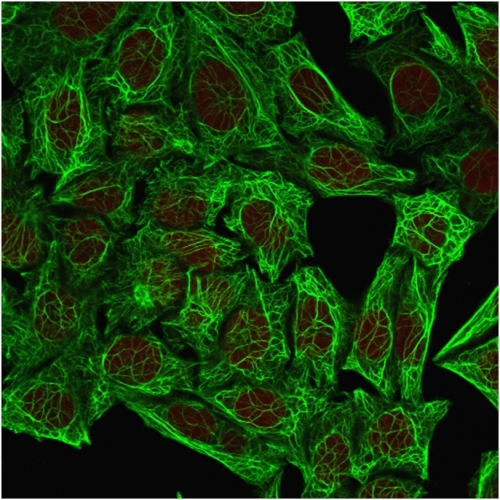 Immunocytochemistry/ Immunofluorescence - Anti-Cytokeratin 7 antibody [OV-TL12/30] (AB216016), expandable thumbnail