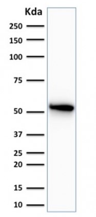 Western blot - Anti-Cytokeratin 7 antibody [OV-TL12/30] (AB216016), expandable thumbnail
