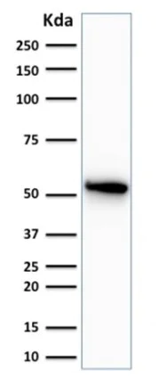 Western blot - Anti-Cytokeratin 7 antibody [OV-TL12/30] (AB216016)