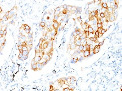 Immunohistochemistry (Formalin/PFA-fixed paraffin-embedded sections) - Anti-Cytokeratin 7 antibody [OV-TL12/30] - BSA and Azide free (AB215887)