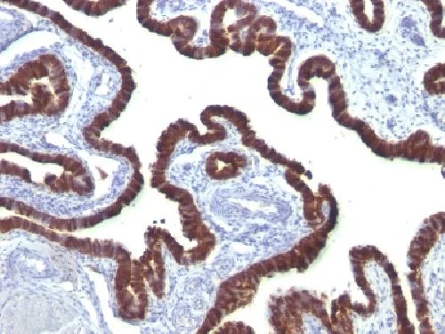 Immunohistochemistry (Formalin/PFA-fixed paraffin-embedded sections) - Anti-Cytokeratin 7 antibody [OV-TL12/30] - BSA and Azide free (AB215887)