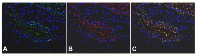 Immunohistochemistry (Formalin/PFA-fixed paraffin-embedded sections) - Anti-Cytokeratin 7 antibody [RCK105] - Cytoskeleton Marker (AB9021)