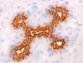 Immunohistochemistry (Frozen sections) - Anti-Cytokeratin 7 antibody [RCK105] - Cytoskeleton Marker (AB9021)