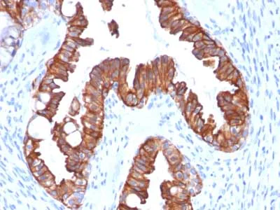Immunohistochemistry (Formalin/PFA-fixed paraffin-embedded sections) - Anti-Cytokeratin 7 antibody [rOV-TL12/30] (AB218439)