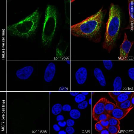 Immunocytochemistry/ Immunofluorescence - Anti-Cytokeratin 7 antibody [SP52] (AB183344)