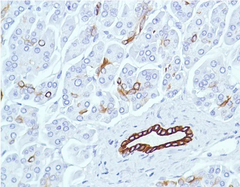 Immunohistochemistry (Formalin/PFA-fixed paraffin-embedded sections) - Anti-Cytokeratin 7 antibody [SP52] (AB183344)