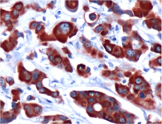 Anti-Cytokeratin 7 antibody [SP52] (ab183344) | Abcam