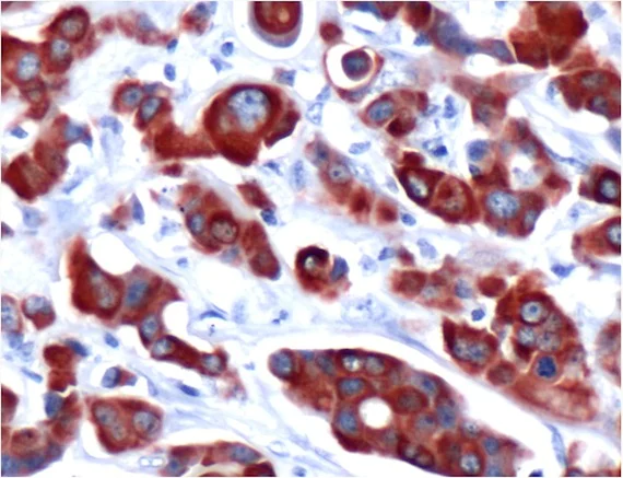 Immunohistochemistry (Formalin/PFA-fixed paraffin-embedded sections) - Anti-Cytokeratin 7 antibody [SP52] (AB183344)