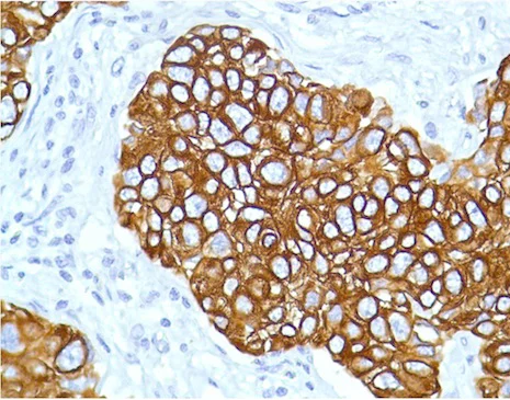 Immunohistochemistry (Formalin/PFA-fixed paraffin-embedded sections) - Anti-Cytokeratin 7 antibody [SP52] (AB183344)