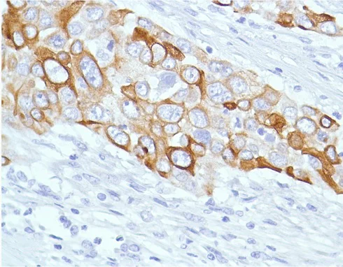 Immunohistochemistry (Formalin/PFA-fixed paraffin-embedded sections) - Anti-Cytokeratin 7 antibody [SP52] (AB183344)