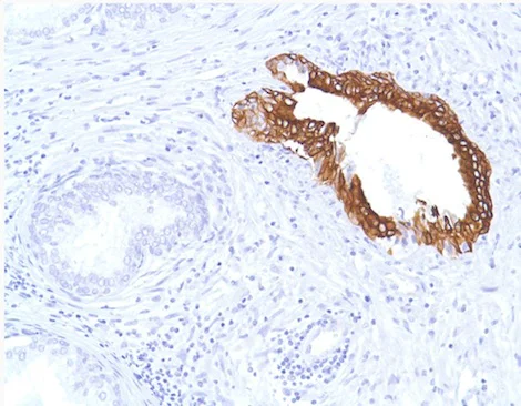 Immunohistochemistry (Formalin/PFA-fixed paraffin-embedded sections) - Anti-Cytokeratin 7 antibody [SP52] (AB183344)