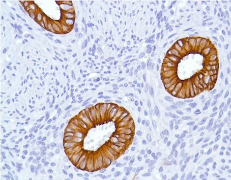Immunohistochemistry (Formalin/PFA-fixed paraffin-embedded sections) - Anti-Cytokeratin 7 antibody [SP52] (AB183344)