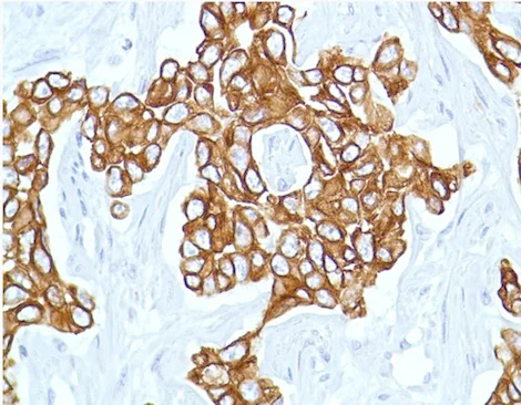Immunohistochemistry (Formalin/PFA-fixed paraffin-embedded sections) - Anti-Cytokeratin 7 antibody [SP52] (AB183344)